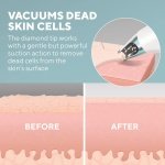 HoMedics Remove Microdermabrasion and Cooling Skincare - Restore Youthful Radiance, Smooth Fine Lines and Improve Skin Tone and Texture - Image 4